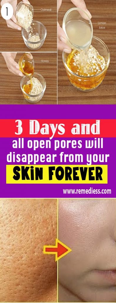 pores beauty treatment